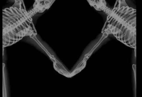 ⃟○━━─°•.ᵁᴿ ᶠᴼᴿ ᴹᴱ ᶠᴼᴿᴱᵛᴱᴿ.•°── ⇆ㅤ in 2022 | Cute black wallpaper, Dark wallpaper iphone, Dark wallpaper