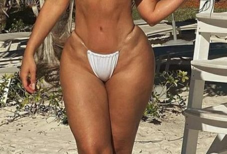People With Rare Features That Make Them Unique
